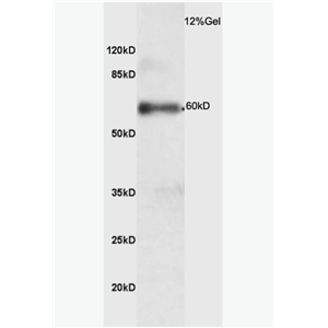 Anti-phospho-IRAK4 (Thr345) antibody-磷酸化白介素-1受体相关激酶4抗体