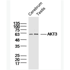 Anti-AKT3 antibody-蛋白激酶B3