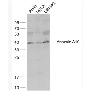 Anti-Annexin A10 antibody-膜粘连蛋白10抗体,Annexin A10