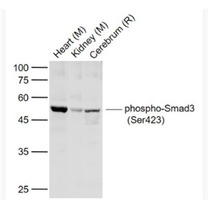 Anti-phospho-Smad3 (Ser423) antibody-磷酸化细胞信号转导分子SMAD3抗体