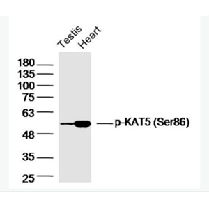 Anti-phospho-KAT5 (Ser86)  antibody-磷酸化组蛋白乙酰转移酶KAT5抗体