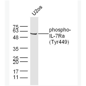 Anti-pphospho-IL7R (Tyr449) antibody-磷酸化白细胞介素-7受体a（CD127）抗体,phospho-IL7R (Tyr449)