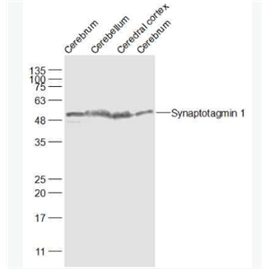 Anti-Synaptotagmin 1 antibody-突触结合蛋白1抗体,Synaptotagmin 1