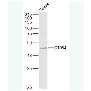 Anti-CT054 antibody-核黄素转运蛋白2抗体