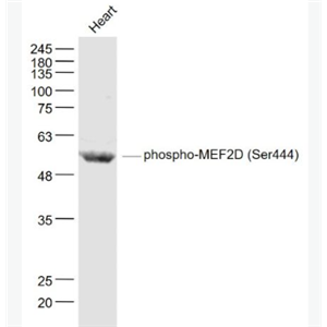 Anti-phospho-MEF2D (Ser444)  antibody-磷酸化肌细胞特异性增强因子2D抗体