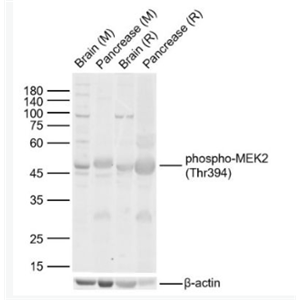 Anti-phospho-MEK2 (Thr394)  antibody-磷酸化丝裂原活化蛋白激酶激酶2抗体