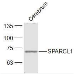 Anti-SPARCL1 antibody-细胞外基质蛋白2抗体,SPARCL1