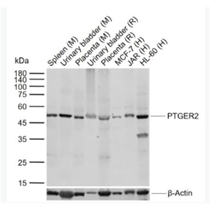 Anti-PTGER2 antibody-前列腺素E2受体2抗体