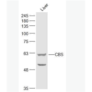 Anti-CBS antibody-丝氨酸羧甲半胱氨酸合成酶抗体,CBS