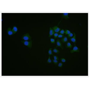 Anti-phospho-RAC1 + RAC2 (Ser71) antibody-磷酸化细胞迁移诱导因子5抗体