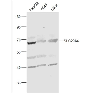 Anti-SLC29A4 antibody-脑质膜单胺转运蛋白PMAT抗体,SLC29A4