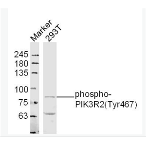 Anti-pphospho-PIK3R2 (Tyr467)  antibody-磷酸化磷脂酰肌醇激酶p85β抗体
