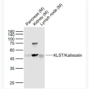 Anti-KLST/Kallistatin antibody-激肽释放酶抑制剂抗体