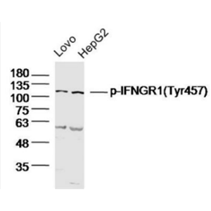 Anti-Phospho-Insulin Receptor (Tyr999)   antibody-磷酸化胰岛素受体抗体