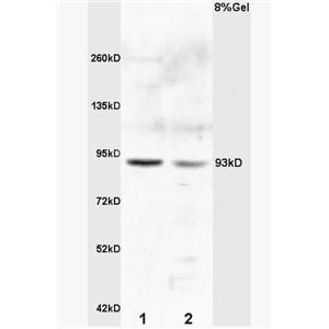 Anti-E2F8  antibody-转录因子E2F8抗体