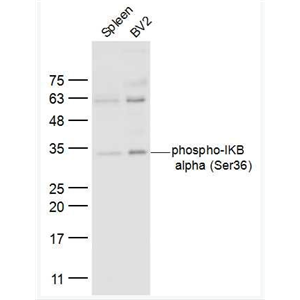 Anti-phphospho-IKB alpha (Ser36)  antibody-磷酸化核因子κB抑制蛋白α抗体体