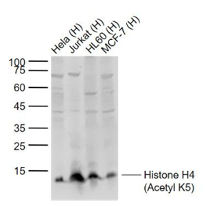 Anti-Histone H4 (Acetyl K5) antibody-乙酰化组蛋白H4抗体