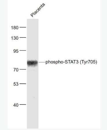 Anti-phospho-AMPK alpha 2 (Ser173) antibody-磷酸化腺苷单磷酸活化蛋白激酶α2抗体,phospho-AMPK alpha 2 (Ser173)