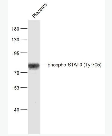 Anti-phospho-AMPK alpha 2 (Ser173) antibody-磷酸化腺苷單磷酸活化蛋白激酶α2抗體,phospho-AMPK alpha 2 (Ser173)