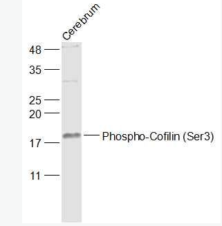 Anti-Phospho-Cofilin (Ser3) antibody-磷酸化丝切蛋白(Ser3)抗体,Phospho-Cofilin (Ser3)