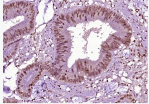 Anti-Phospho-eNOS (Thr495) antibody-磷酸化一氧化氮合成酶3（內皮型）抗體,Phospho-eNOS (Thr495)