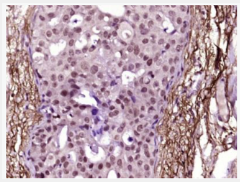 Anti-phospho-JAK2 (Tyr221) antibody-磷酸化蛋白酪氨酸激酶JAK-2抗體,phospho-JAK2 (Tyr221)