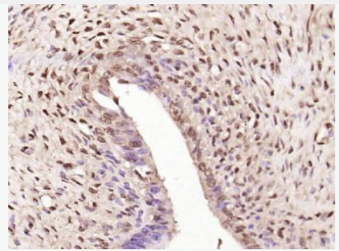 Anti-Phospho-NFKB1 (Ser927)  antibody-磷酸化细胞核因子p50/k基因结合核因子抗体,Phospho-NFKB1 (Ser927)