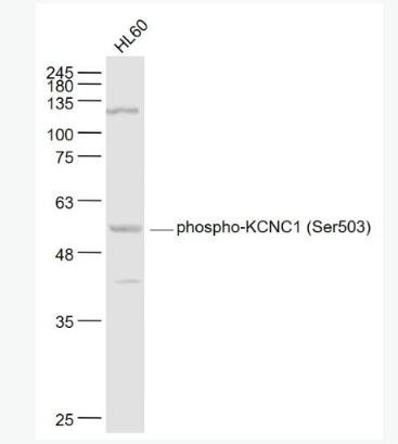 Anti-phospho-KCNC1 (Ser503) antibody-磷酸化离子通道蛋白Kv3.1抗体,phospho-KCNC1 (Ser503)