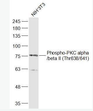Anti-Phospho-PKC alpha (Thr638)  antibody-磷酸化蛋白激酶C α/β2抗体,Phospho-PKC alpha (Thr638)
