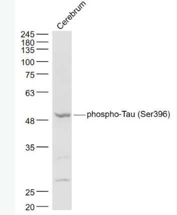 Anti-phospho-Tau (Ser396)  antibody-磷酸化微管相關(guān)蛋白抗體,phospho-Tau (Ser396)