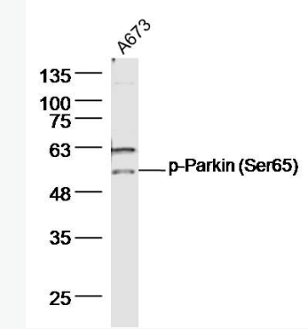 Anti-phospho-Parkin (Ser65)  antibody-磷酸化帕金森病蛋白2抗体,phospho-Parkin (Ser65)