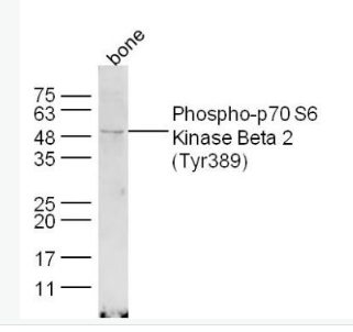 Anti-Phospho-p70 S6 Kinase Beta 2 (Tyr389) antibody-磷酸化核糖體S6蛋白激酶β2抗體,Phospho-p70 S6 Kinase Beta 2 (Tyr389)