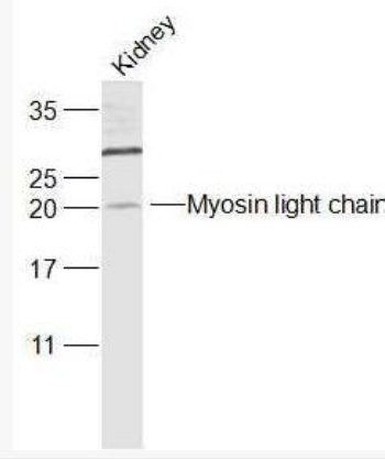 Anti-Myosin light chain (phospho S20) antibody-磷酸化肌球蛋白調(diào)節(jié)多肽9(平滑肌亞型)抗體,Myosin light chain (phospho S20)