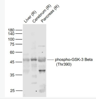 Anti-phospho-GSK-3 Beta (Thr390) antibody-磷酸化糖原合酶激酶3β抗體,phospho-GSK-3 Beta (Thr390)