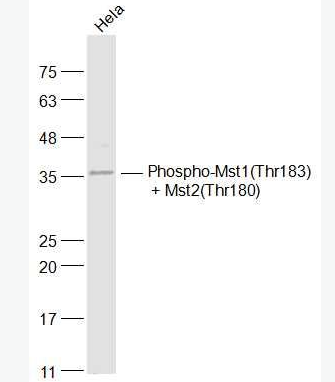 Anti-Phospho-Mst1(Thr183) + Mst2(Thr180) antibody-磷酸化蛋白激酶MST抗体,Phospho-Mst1(Thr183) + Mst2(Thr180)