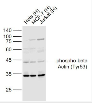 Anti-phospho-beta Actin (Tyr53) antibody-磷酸化β-肌動蛋白抗體,phospho-beta Actin (Tyr53)