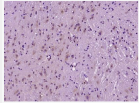 Anti-phospho-AMPK beta 1 (Ser108) antibody-磷酸化腺苷單磷酸活化蛋白激酶β1抗體,phospho-AMPK beta 1 (Ser108)