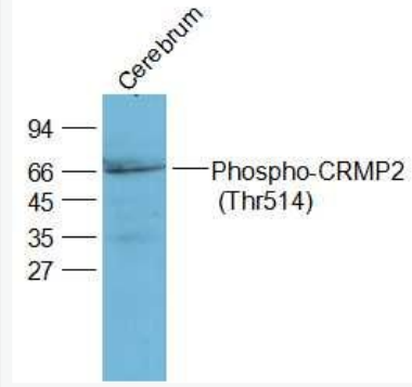 Anti-Phospho-CRMP2 (Thr514) antibody-磷酸化二氫嘧啶酶樣2(CRMP2/DPYL2)抗體,Phospho-CRMP2 (Thr514)