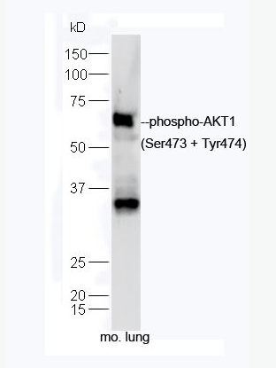 Anti-phospho-AKT1 (Ser473 + Tyr474) antibody-磷酸化蛋白激酶AKT1抗体,phospho-AKT1 (Ser473 + Tyr474)