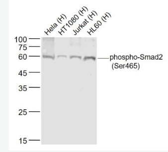 Anti-phospho-Smad2 (Ser465) antibody-磷酸化Smad2抗體,phospho-Smad2 (Ser465)