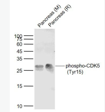 Anti-phospho-CDK5 (Tyr15)  antibody-磷酸化周期素依赖性激酶5抗体,phospho-CDK5 (Tyr15)