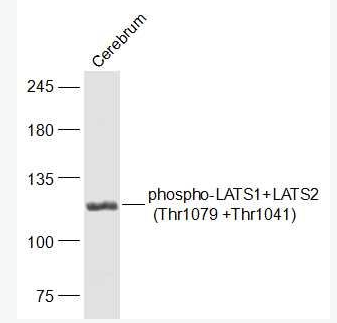 Anti-phospho-LATS1+LATS2 (Thr1079 +Thr1041) antibody-磷酸化肿瘤抑制基因LATS1/LATS2抗体,phospho-LATS1+LATS2 (Thr1079 +Thr1041)