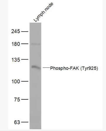 Anti-Phospho-FAK (Tyr925) antibody-磷酸化粘着斑激酶抗体,Phospho-FAK (Tyr925)