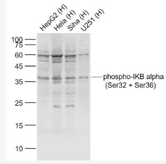 Anti-phospho-IKB alpha (Ser32 + Ser36) antibody-磷酸化p-IκB-α抗体,phospho-IKB alpha (Ser32 + Ser36)