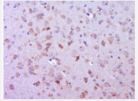 Anti-phospho-FAK (Ser732) antibody-磷酸化粘著斑激酶抗體,phospho-FAK (Ser732)