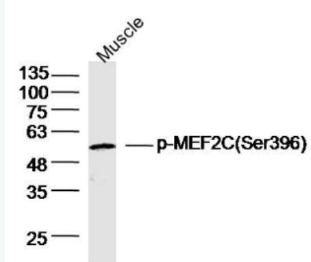 Anti-phospho-MEF2C (Ser396) antibody-磷酸化肌细胞增强因子2C抗体,phospho-MEF2C (Ser396)