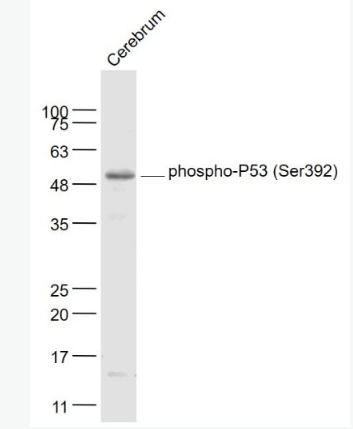 Anti-phospho-P53 (Ser392) antibody-磷酸化腫瘤抑制基因P53抗體,phospho-P53 (Ser392)