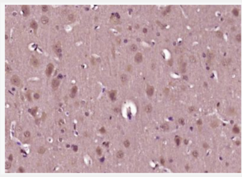 Anti-phospho-Akt (Thr450) antibody-磷酸化蛋白激酶B抗體,phospho-Akt (Thr450)