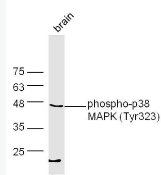 Anti-phospho-p38 MAPK (Tyr323) antibody-磷酸化p38MAPK抗體,phospho-p38 MAPK (Tyr323)