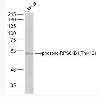 Anti-phospho-RPS6KB1 (Thr412) antibody-磷酸化核糖体S6蛋白激酶抗体,phospho-RPS6KB1 (Thr412)
